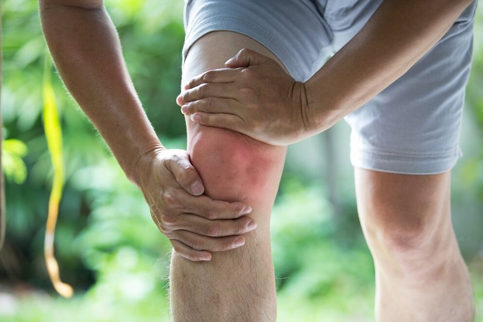 Bol u zglobovima je najuočljivija manifestacija artroze i artritisa. 