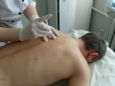 Intraartikularne injekcije hondroprotektora za torakalnu osteohondrozu